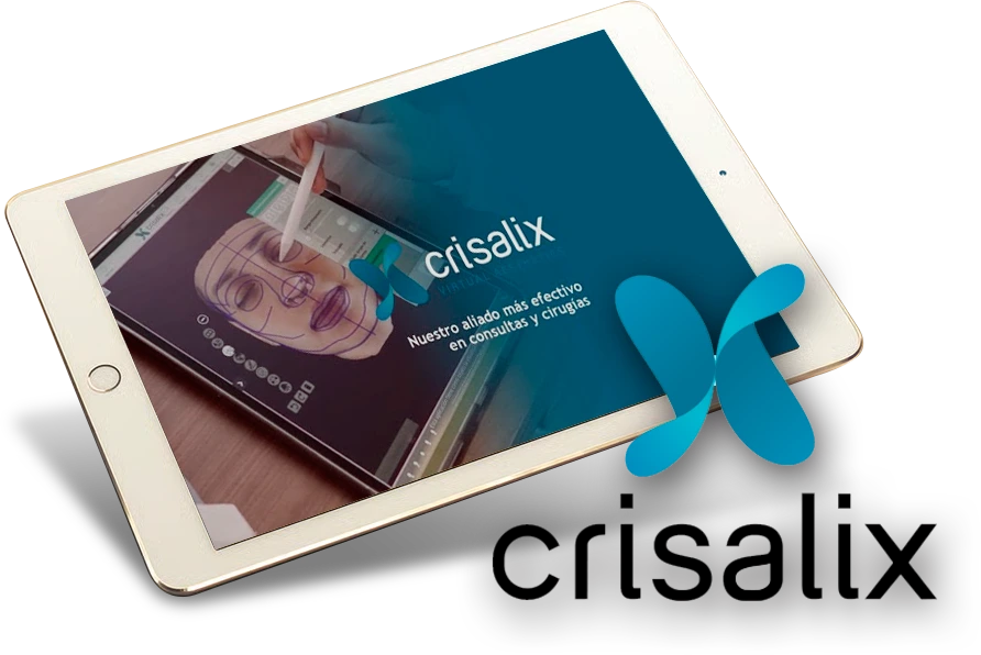 Simulación 3D Crisalix - Ganssthetic